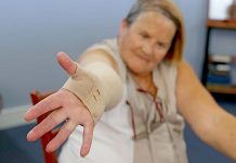 Urgent call for Lymphoedema subsidy